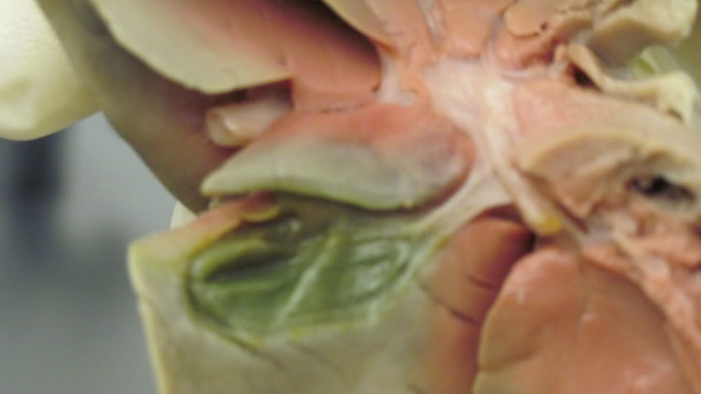 fetal-pig-gallbladder-photo-by-kbrinegar-photobucket